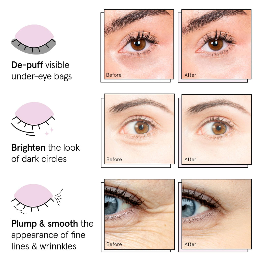 grace & stella Retinol Under Eye Patches for Puffy Eyes & Dark Circles - Restoring Gel Under Eye Masks with Hyaluronic Acid - Birthday Gifts for Women, Bachelorette Party Favors (Purple, 24 Pairs)